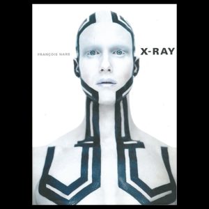 X-Ray